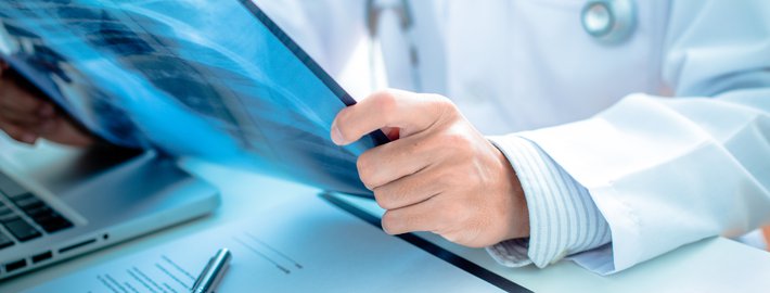 Реабилитация после перенесенной инфекции COVID-19 (2023 г.)