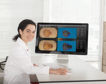 ИССЛЕДОВАНИЕ НОВООБРАЗОВАНИЙ КОЖИ НА АППАРАТЕ FotoFinder (Германия) на Ломоносовском