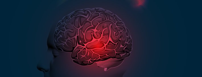 Check-up для определения риска развития инсульта