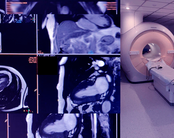 МРТ - сверхточная диагностика заболеваний сердечно-сосудистой системы