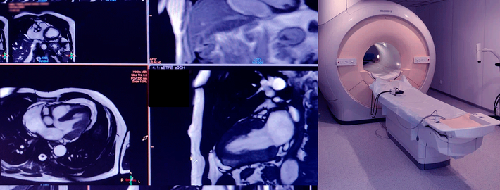 МРТ - сверхточная диагностика заболеваний сердечно-сосудистой системы